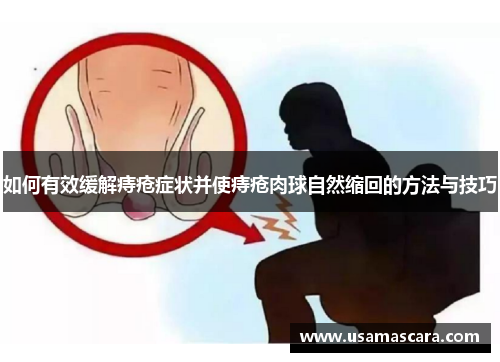 如何有效缓解痔疮症状并使痔疮肉球自然缩回的方法与技巧